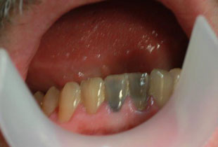 cosmetic-dentistry_before-03