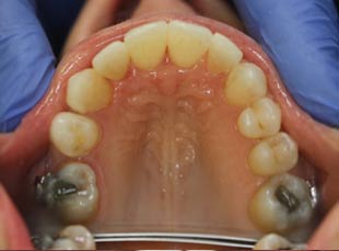 Orthodontics After
