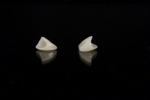 All About Dental Veneers | Cosmetic Dentistry