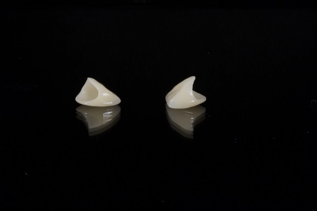 All About Dental Veneers | Cosmetic Dentistry